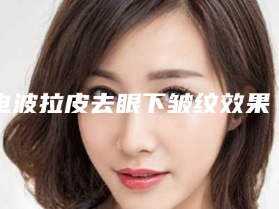 电波拉皮去眼下皱纹效果好不好(电波拉皮祛除眼下皱纹)