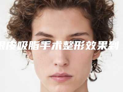 眼皮吸脂手术整形效果到底怎么样